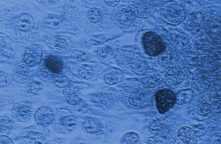 Photomicrograph depicts a McCoy cell monolayer culture, which has been inoculated with Chlamydia trachomatis bacteria. Credit: CDC/ Dr. E. Arum; Dr. N. Jacobs