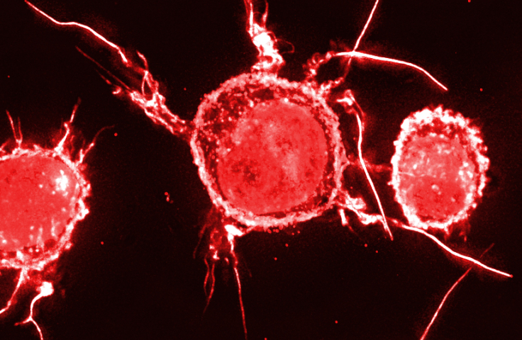 Micrograph of HIV cells. Credit: Stuart Turville