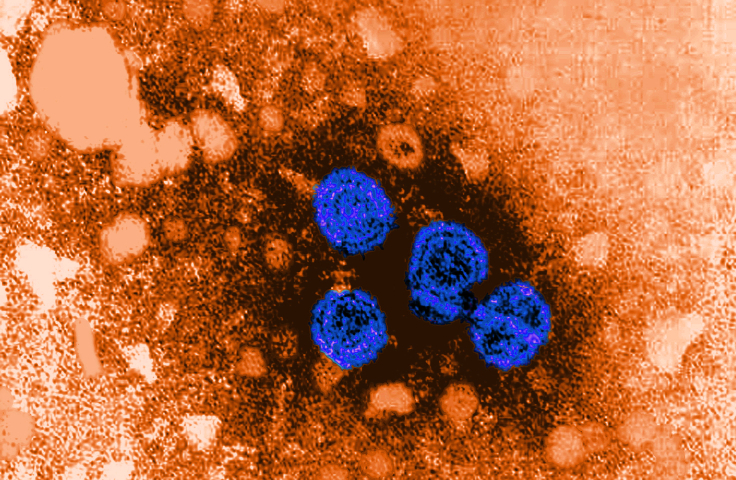 Transmission electron microscopic (TEM) image shows hepatitis B virus (HBV) particles (blue). Credit: CDC/Dr Erskine Palmer