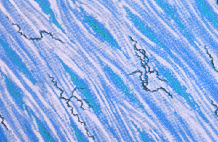 Photomicrograph of a culture specimen processed using the Levaditi staining method, and reveals the presence of corkscrew shaped, Treponema pallidum bacteria, which is the cause of syphilis. Credit: CDC