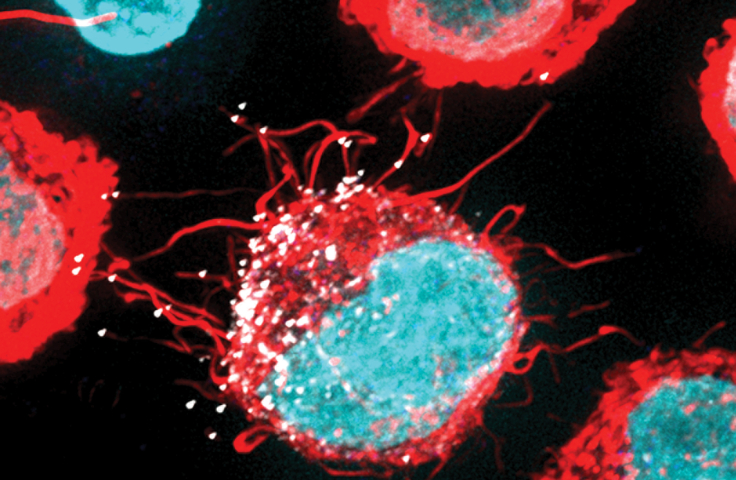 Microphotograph of HIV cells. Credit: Kirby Institute/Stuart Turville