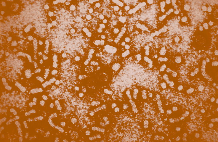 Photomicrograph of hepatitis B cells in a brown tint. Credit: CDC