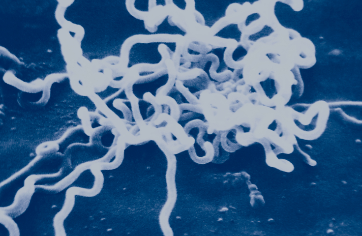 Microphotograph of syphilis cells tinted blue. Credit: CDC/Dr David Cox